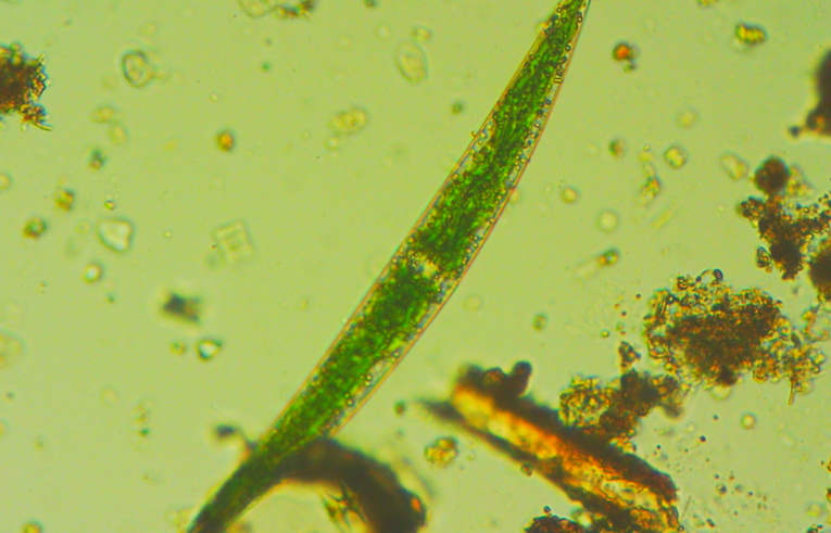 alga - Closterium