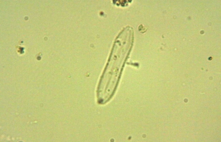 alga - Cymatopleura