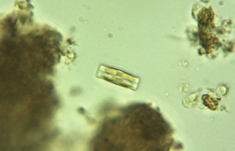 alga - Diatom