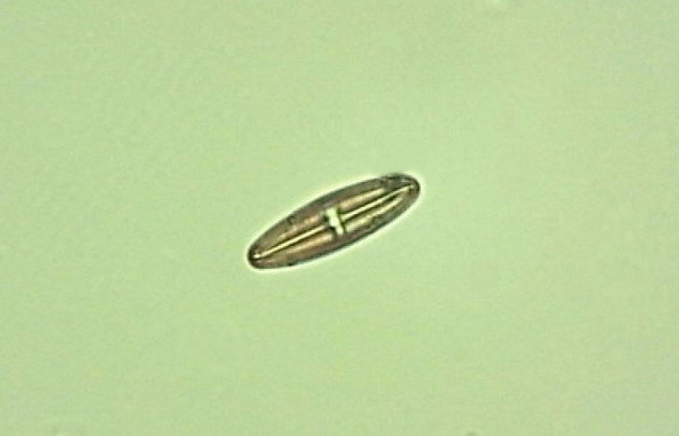 alga - Achnanthes