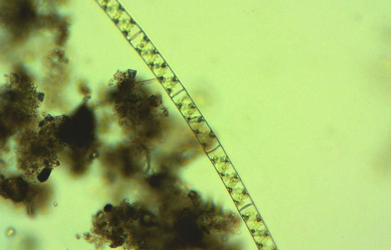 alga - Spirogyra