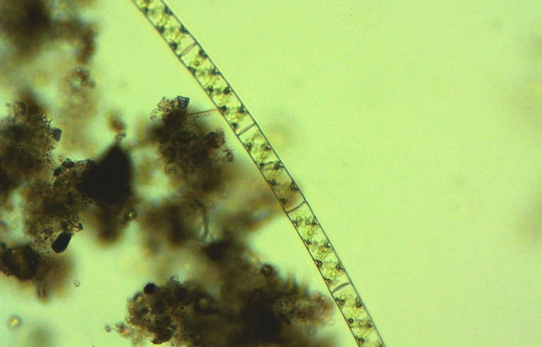 alga - Spirogyra