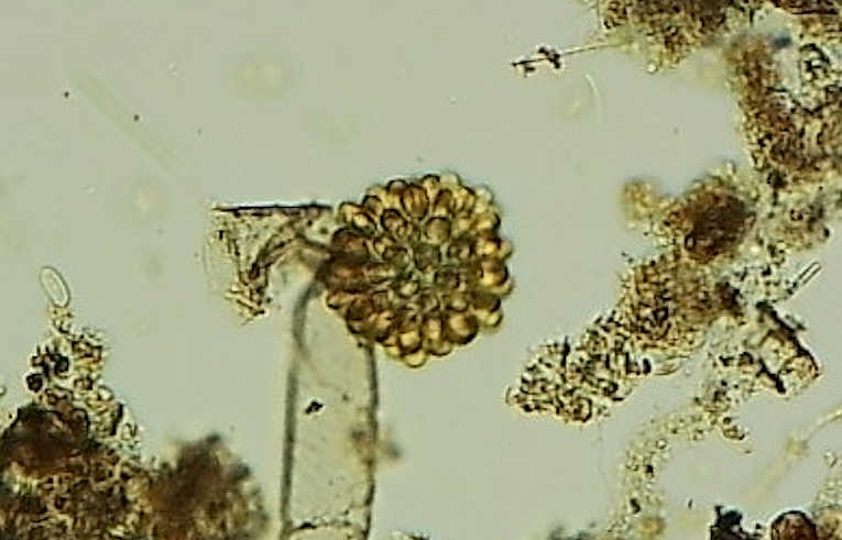 alga - Coelastrum