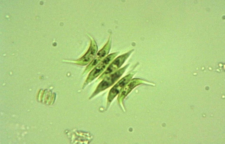 Tetradesmus