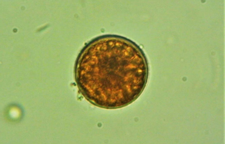 alga - Trachelomonas