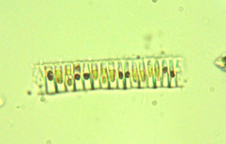 alga - Ulothrix