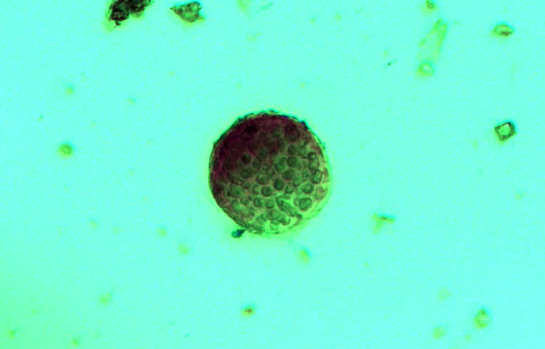 alga - Volvox