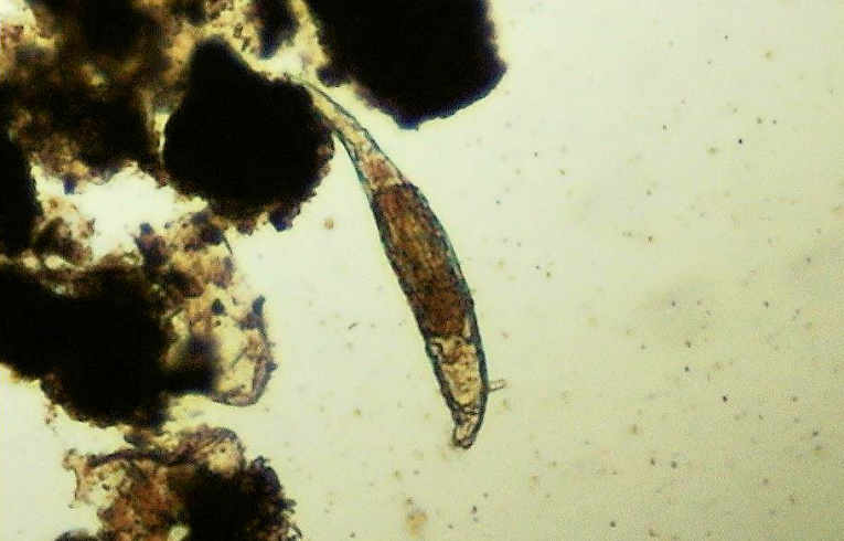 rotifer - Habrotrocha
